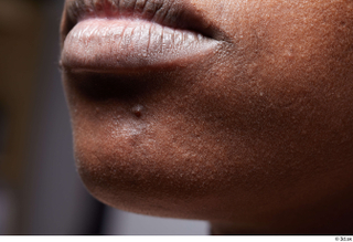 Photos Shamone Glenn HD Face skin references lips mouth skin…